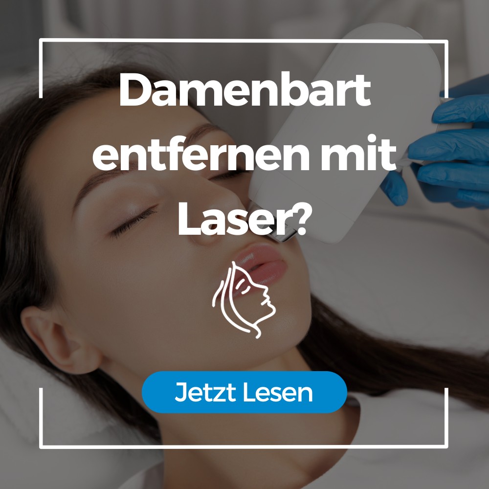 Damenbart entfernen mit Laser Damenbart