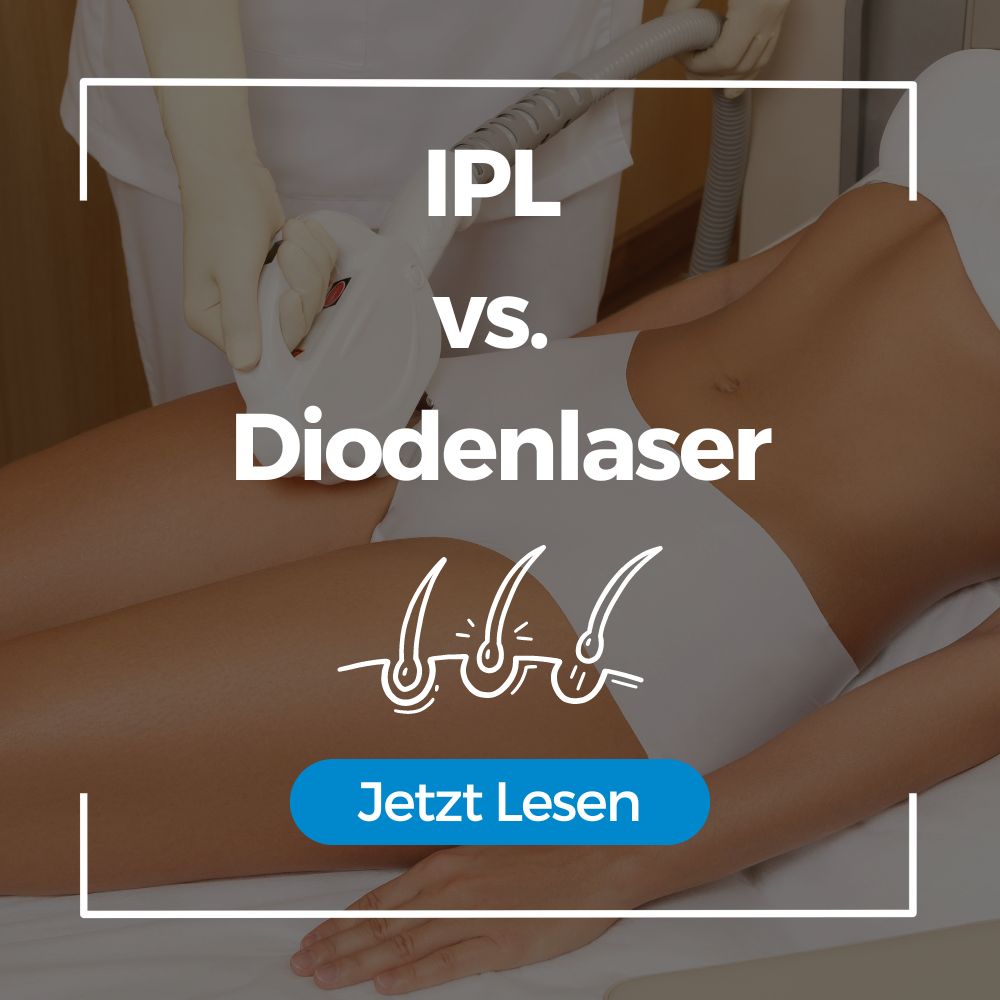 IPL vs. Diodenlaser