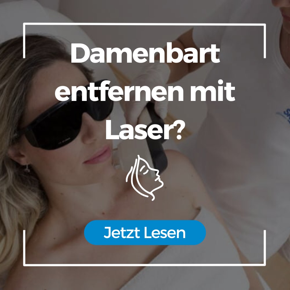 Damenbart entfernen mit Laser